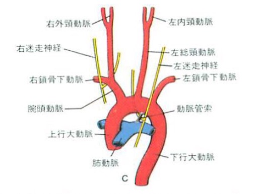 画像_肺動脈静脈